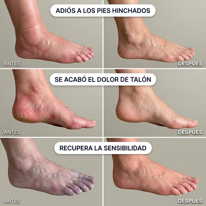 TheraPie™ — Masajeador 3-en-1: Elimina Hinchazón, Neuropatía y Fascitis en 15 Minutos